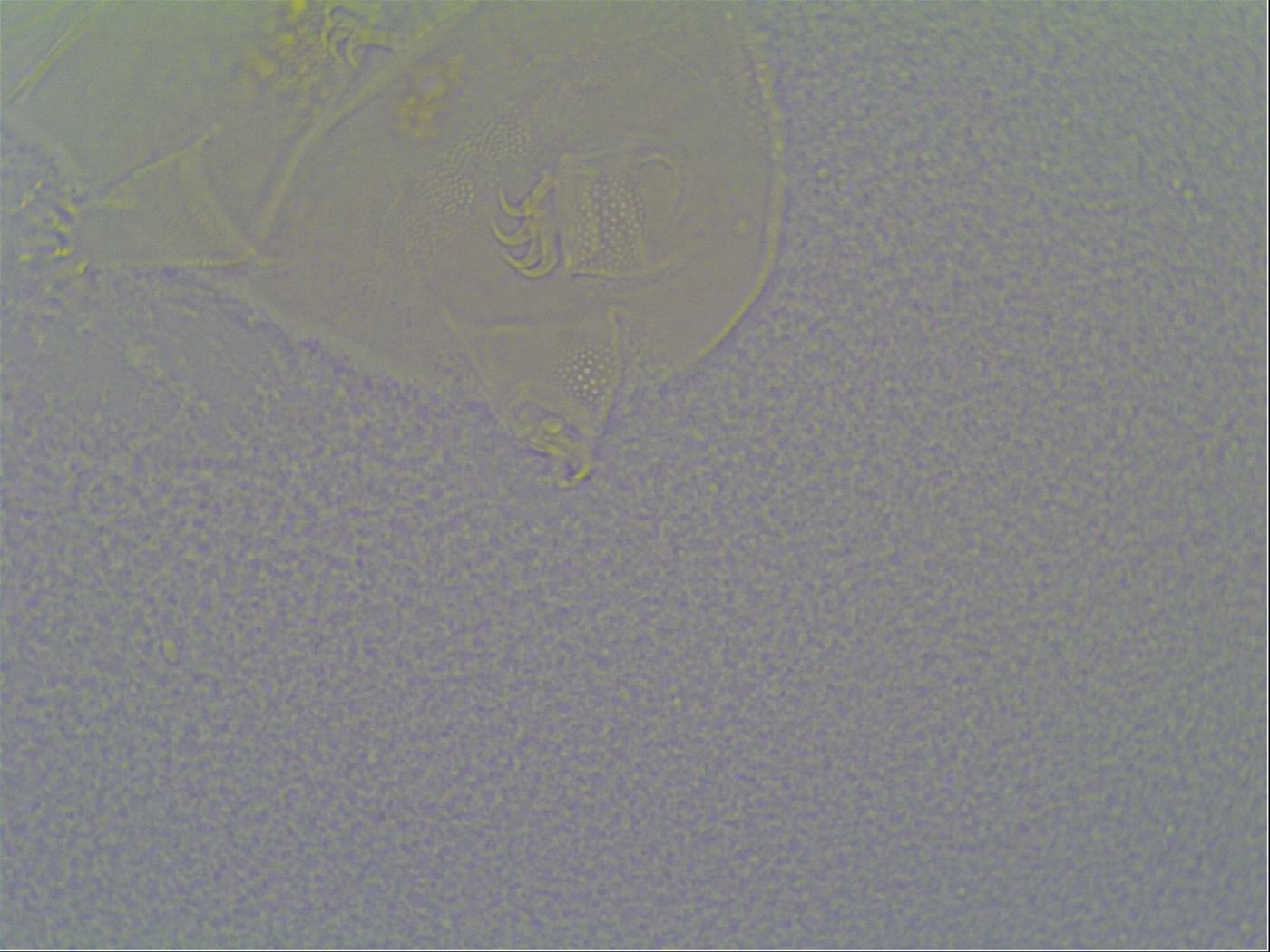 Pseudechiniscus suillus image