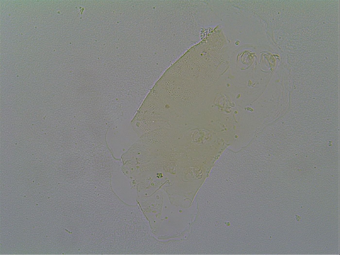 Pseudechiniscus suillus image