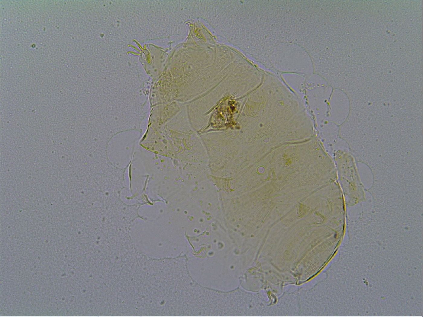 Pseudechiniscus suillus image