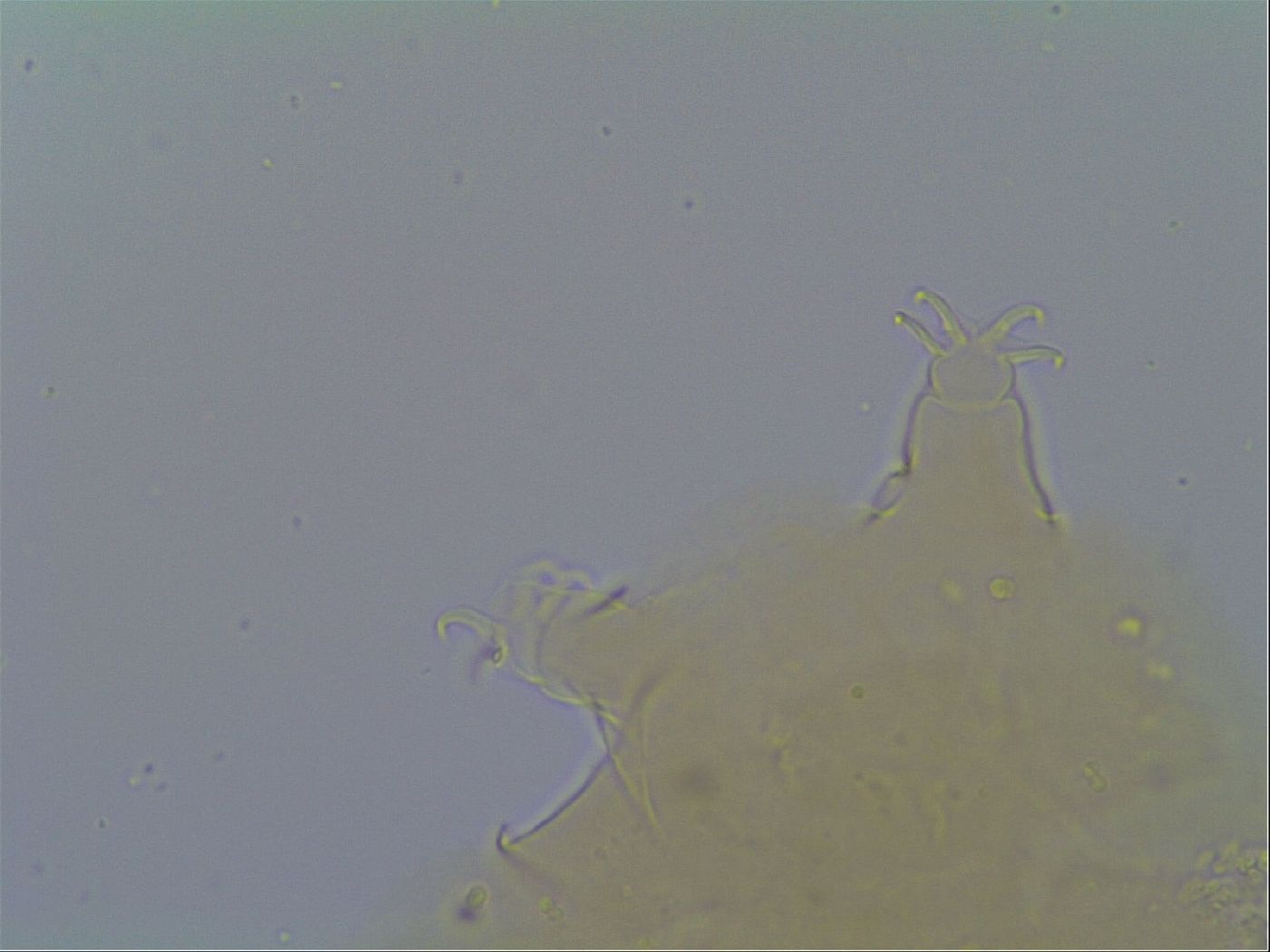 Pseudechiniscus suillus image