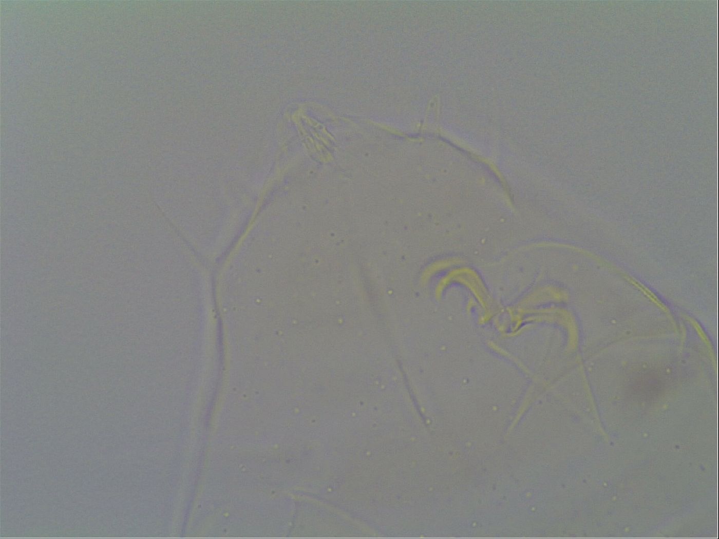 Multipseudechiniscus raneyi image