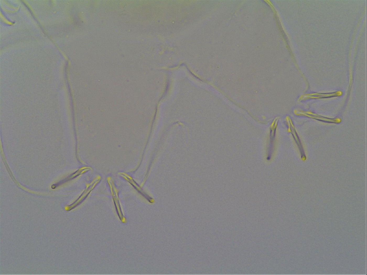 Multipseudechiniscus raneyi image
