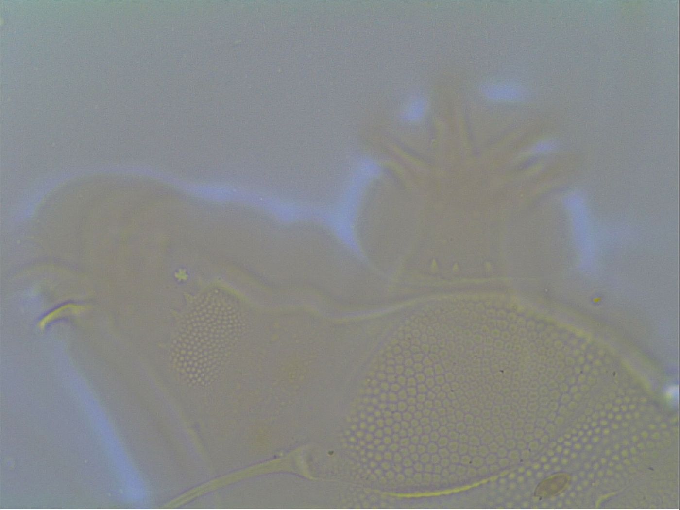 Multipseudechiniscus raneyi image
