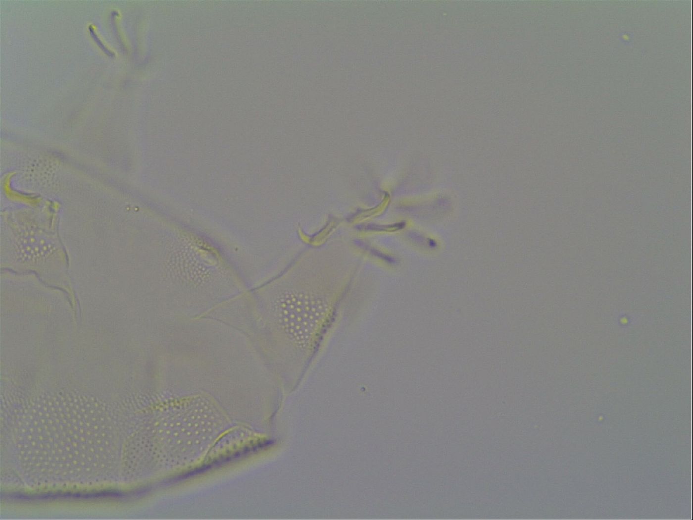 Pseudechiniscus ramazzottii image