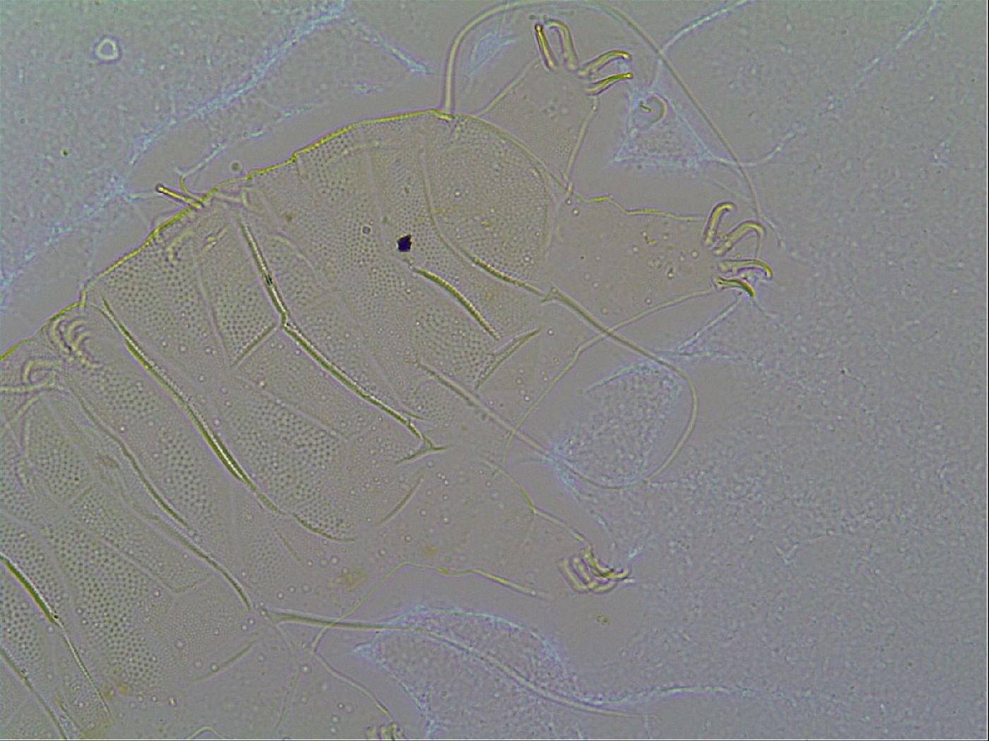 Multipseudechiniscus image