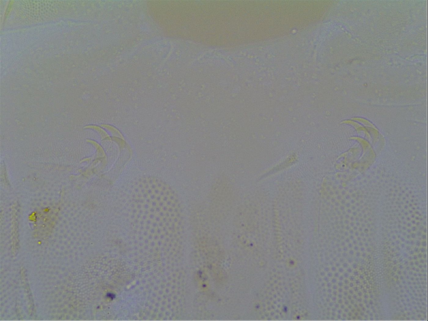 Multipseudechiniscus raneyi image