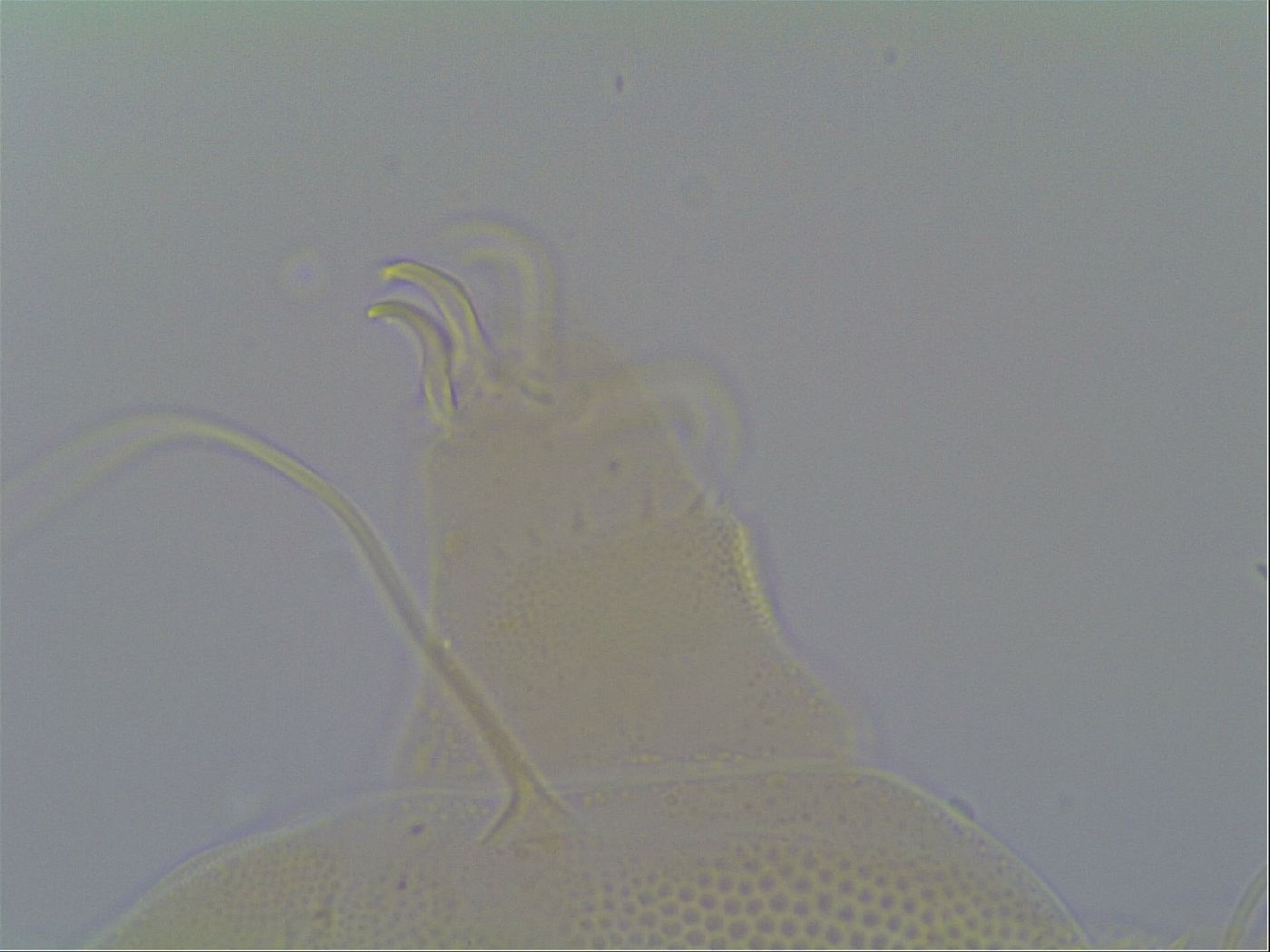 Multipseudechiniscus raneyi image