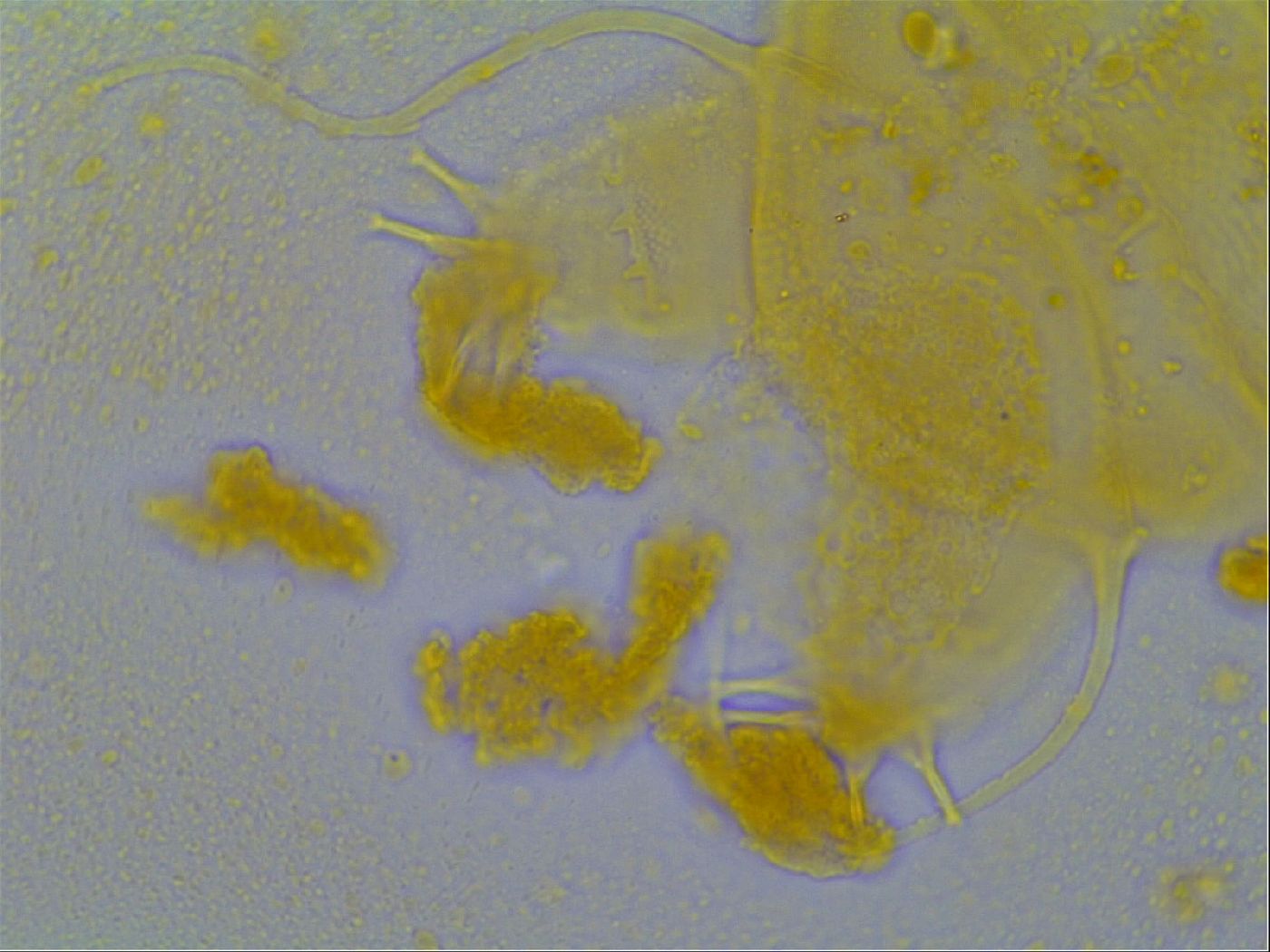 Multipseudechiniscus raneyi image