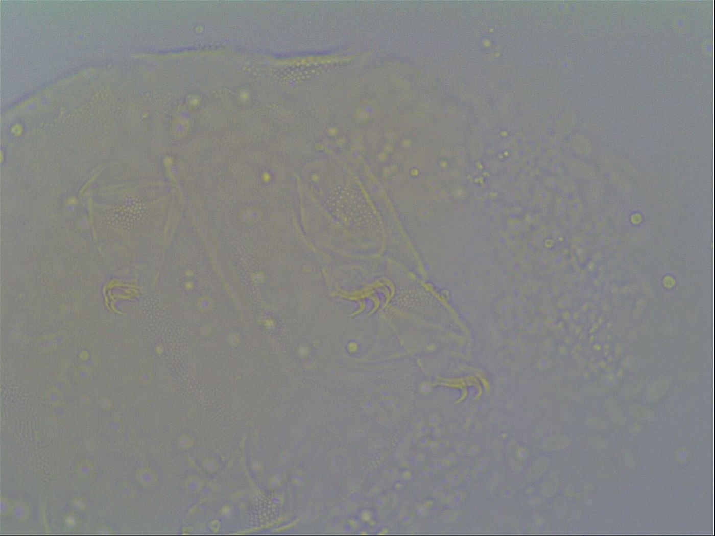 Pseudechiniscus suillus image