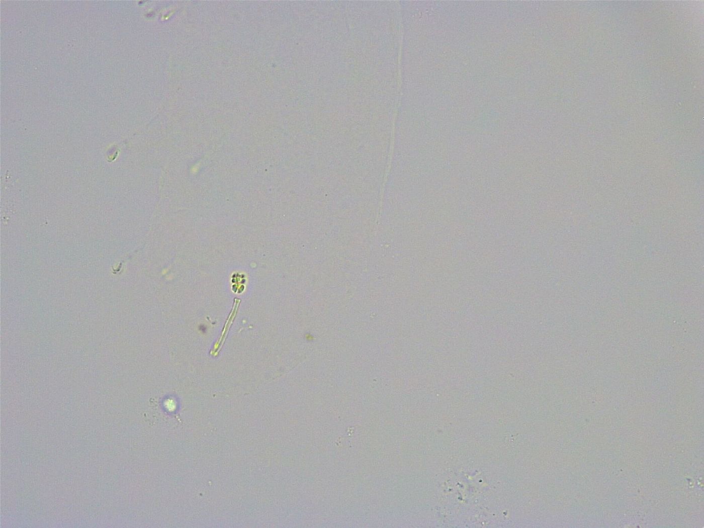 Minibiotus intermedius image