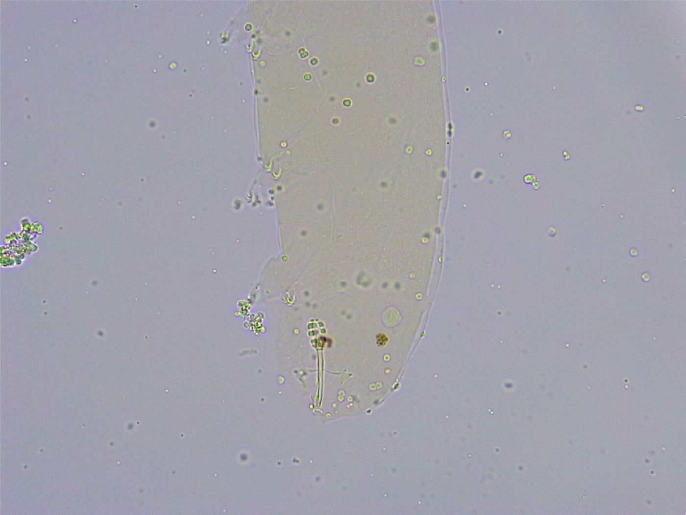 Minibiotus intermedius image