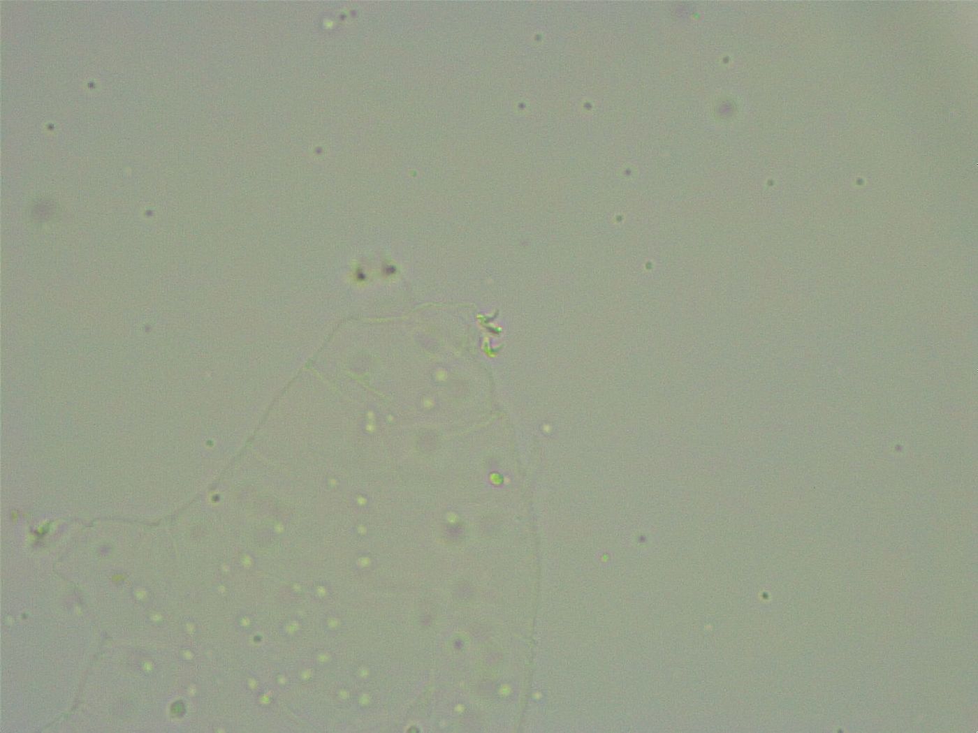 Minibiotus intermedius image