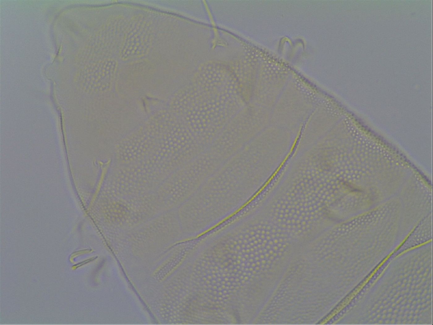 Pseudechiniscus image