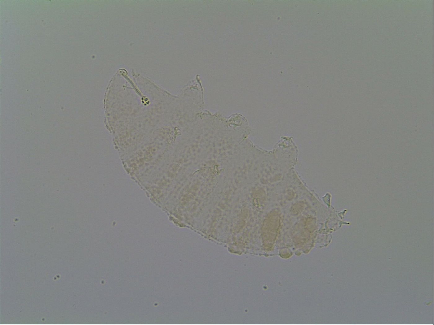 Calohypsibius placophorus image