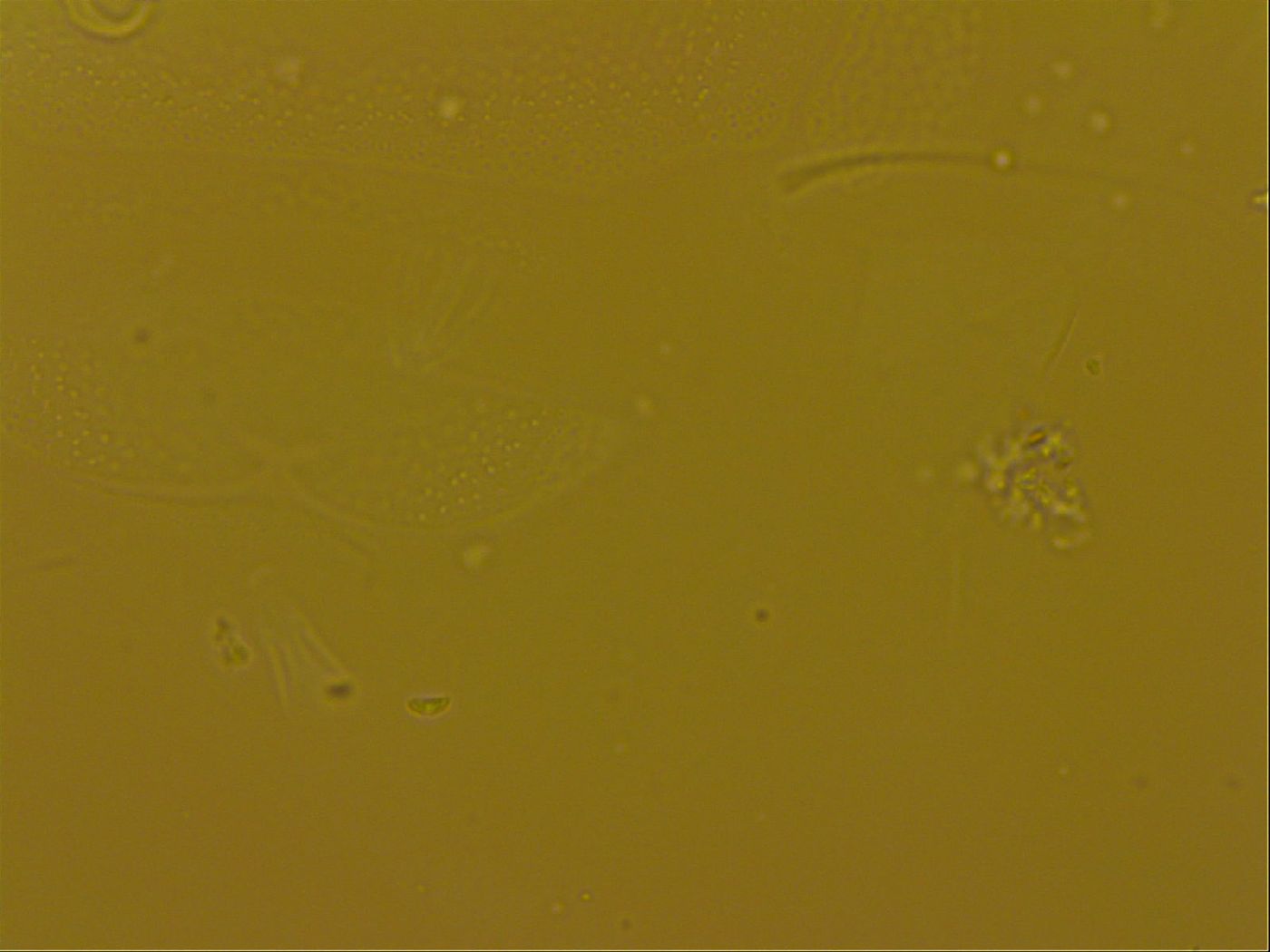 Echiniscus quadrispinosus image