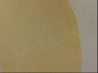 Ramazzottius oberhaeuseri image