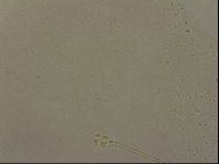 Ramazzottius oberhaeuseri image
