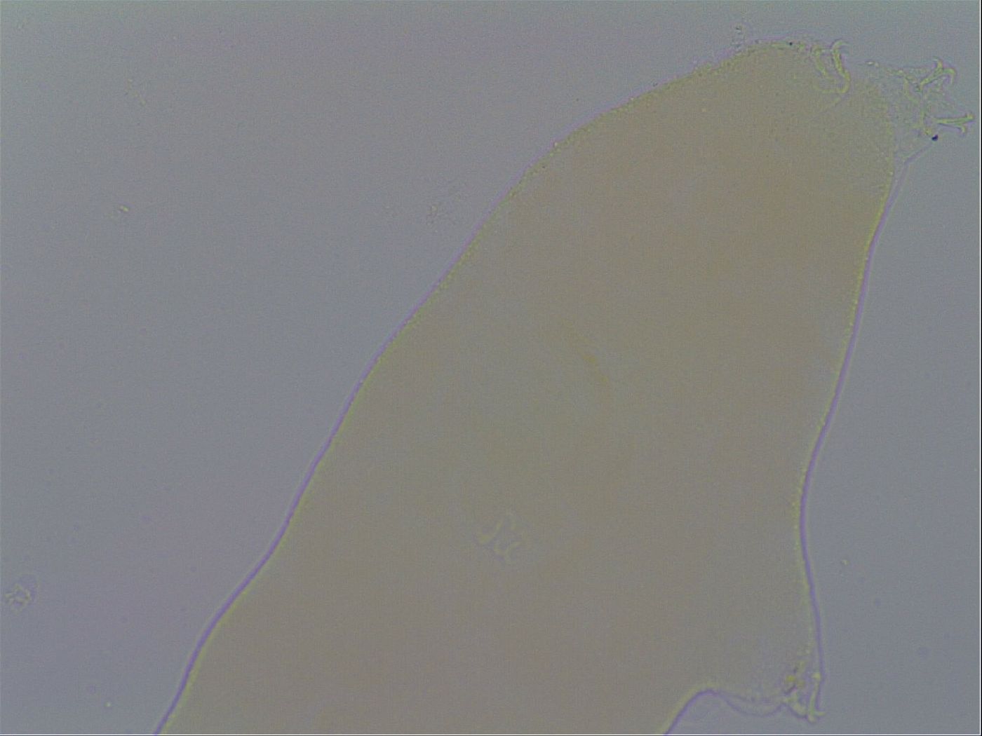 Macrobiotus echinogenitus image