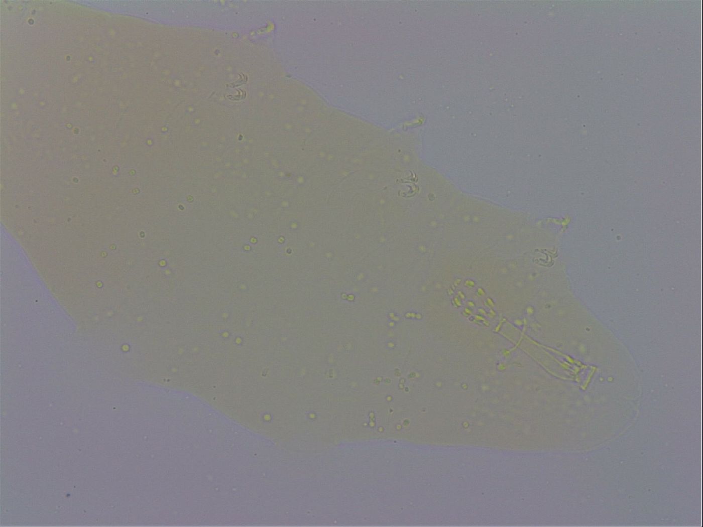Mesobiotus coronatus image