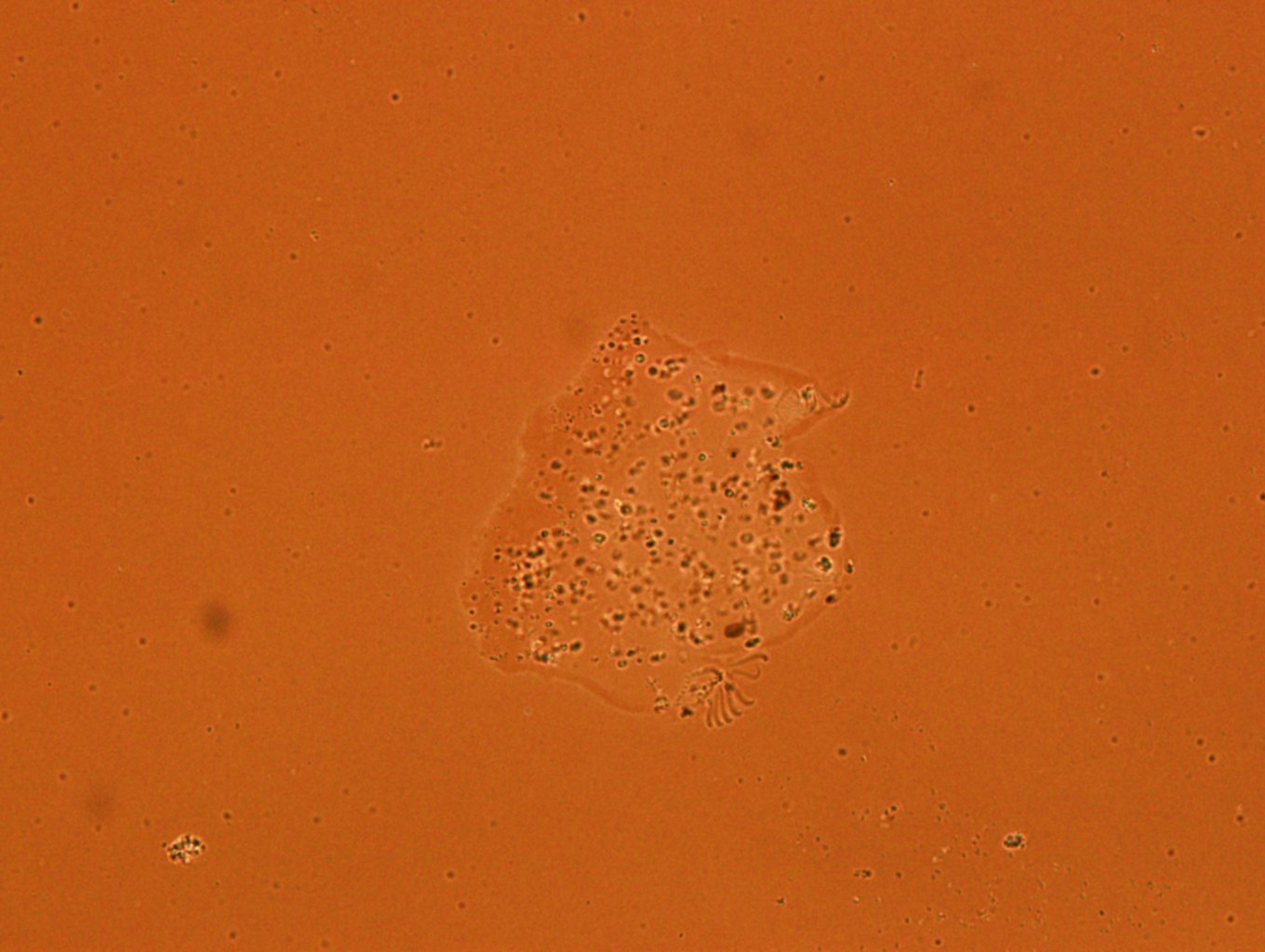 Echiniscoides image