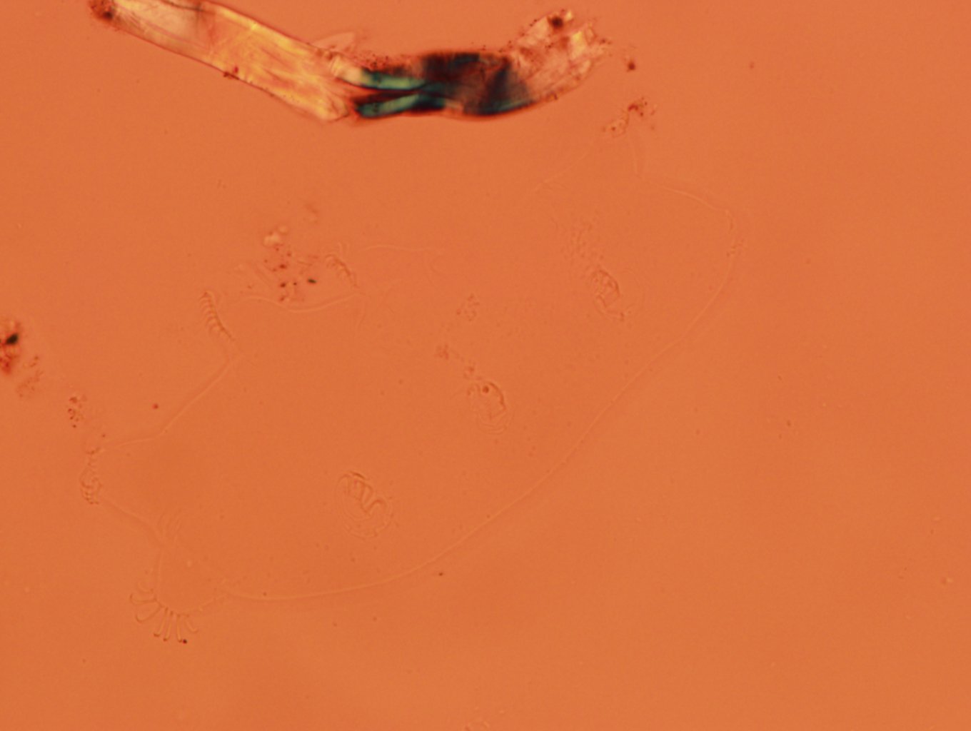 Echiniscoides sigismundi image