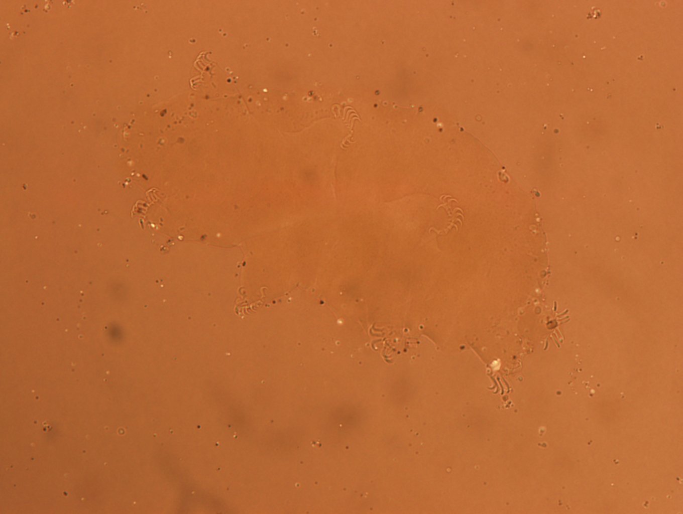 Echiniscoides sigismundi image