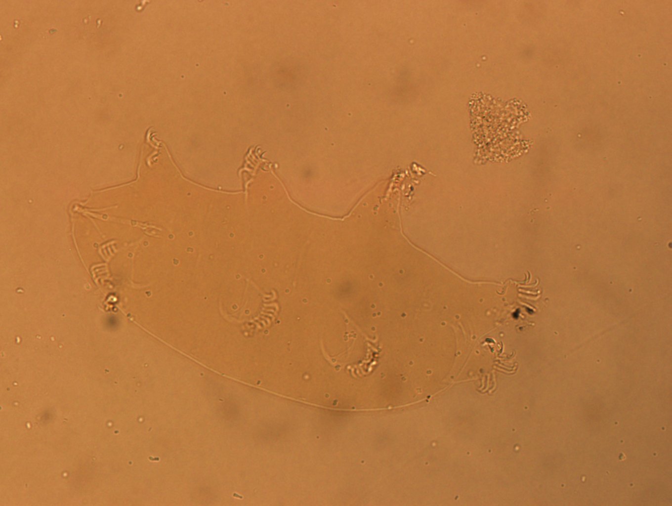 Echiniscoides sigismundi image