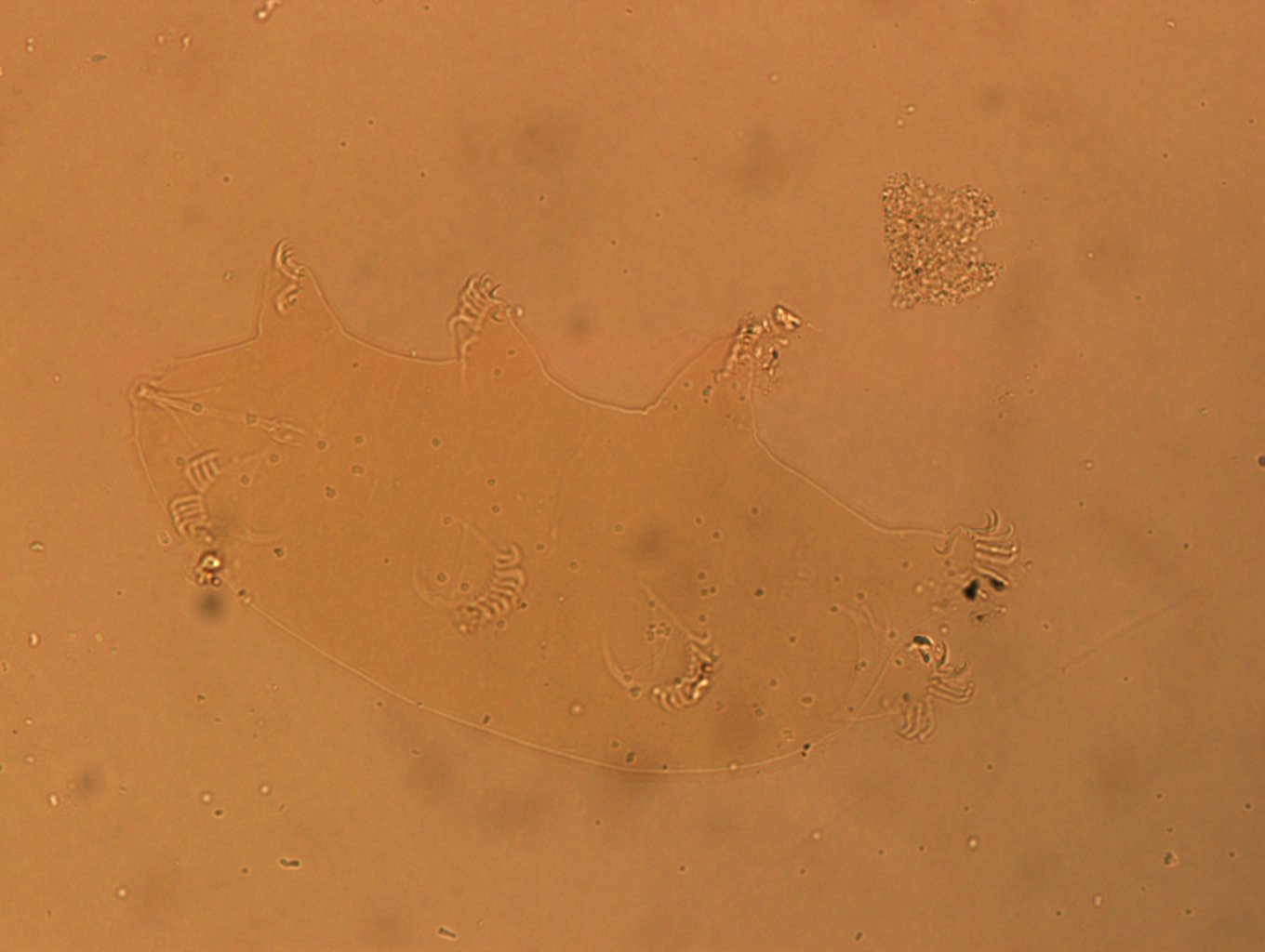 Echiniscoides sigismundi image