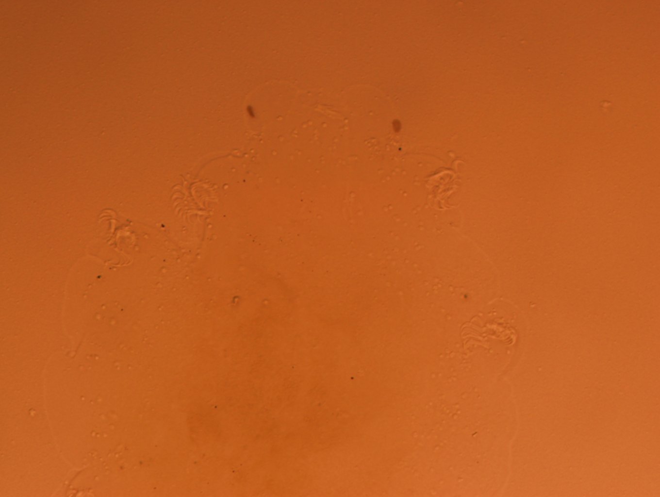Echiniscoididae image