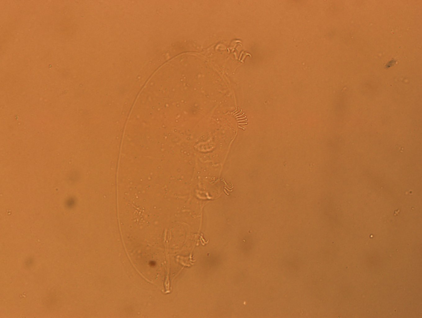Echiniscoididae image