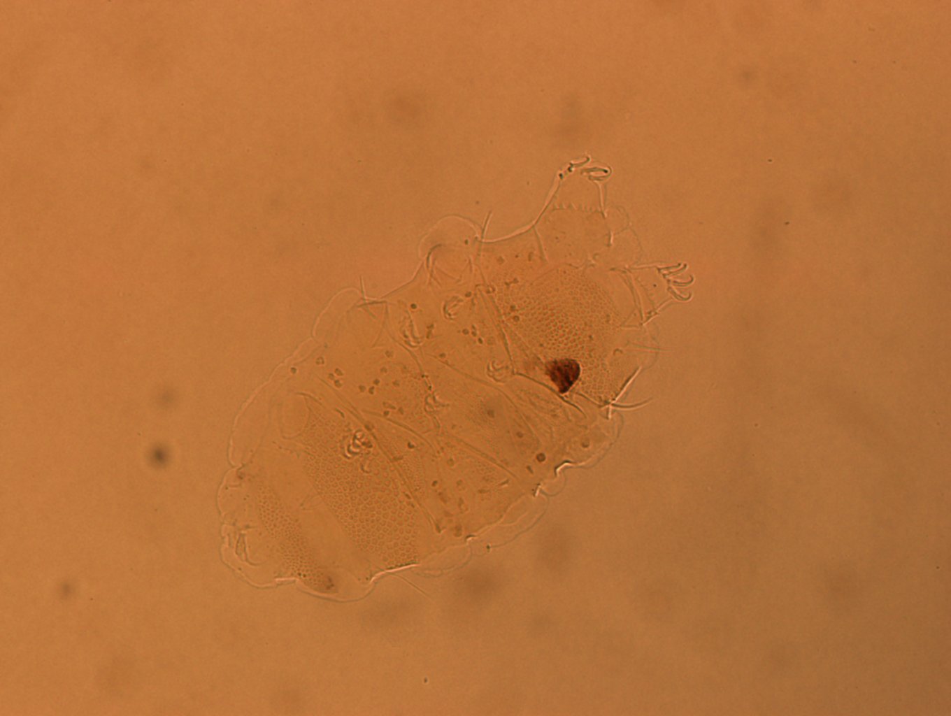 Echiniscus africanus image