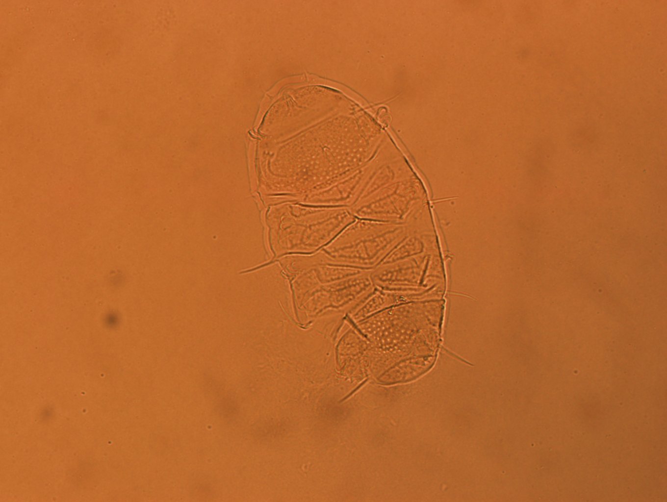 Echiniscus africanus image