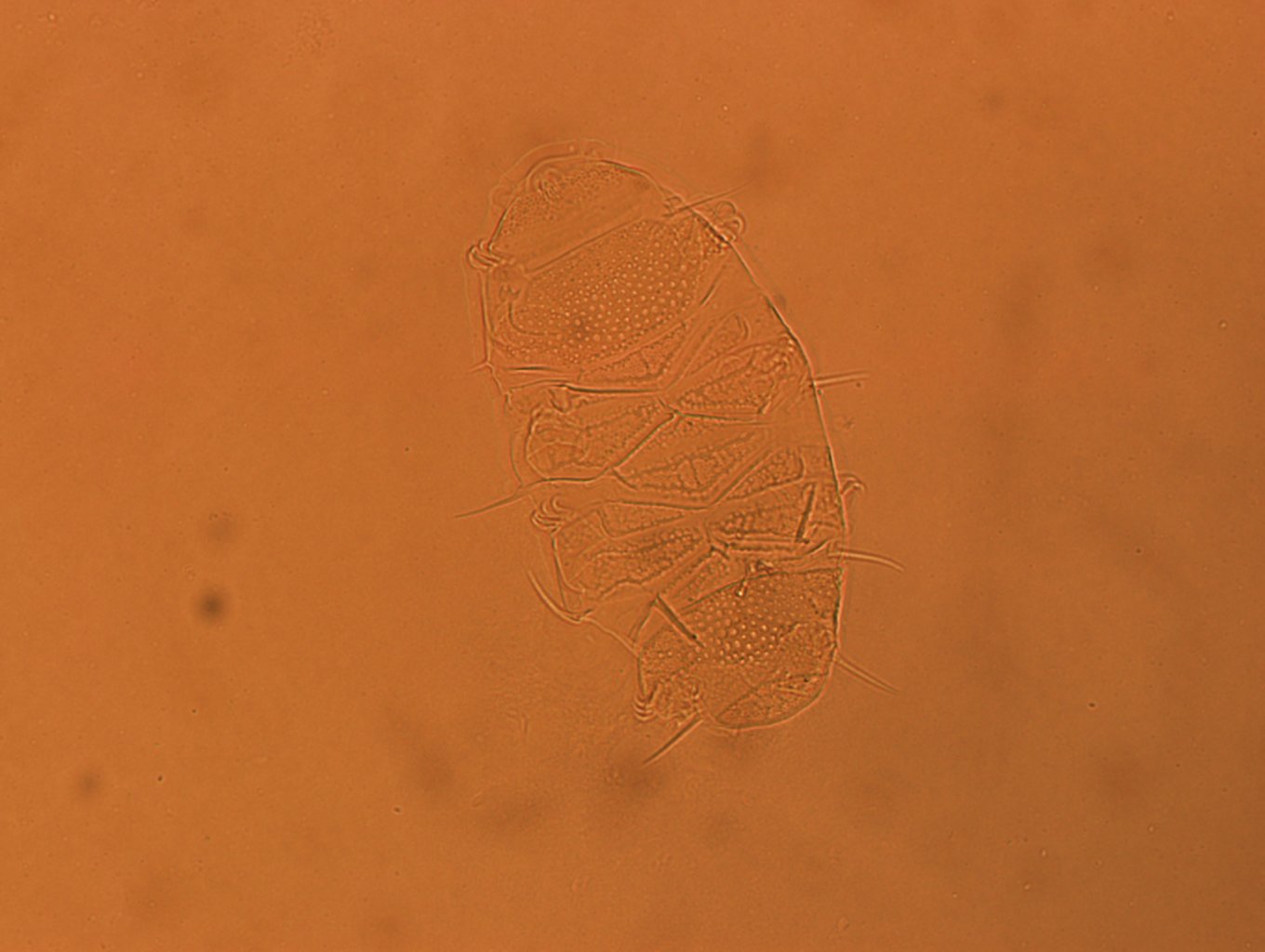 Echiniscus africanus image