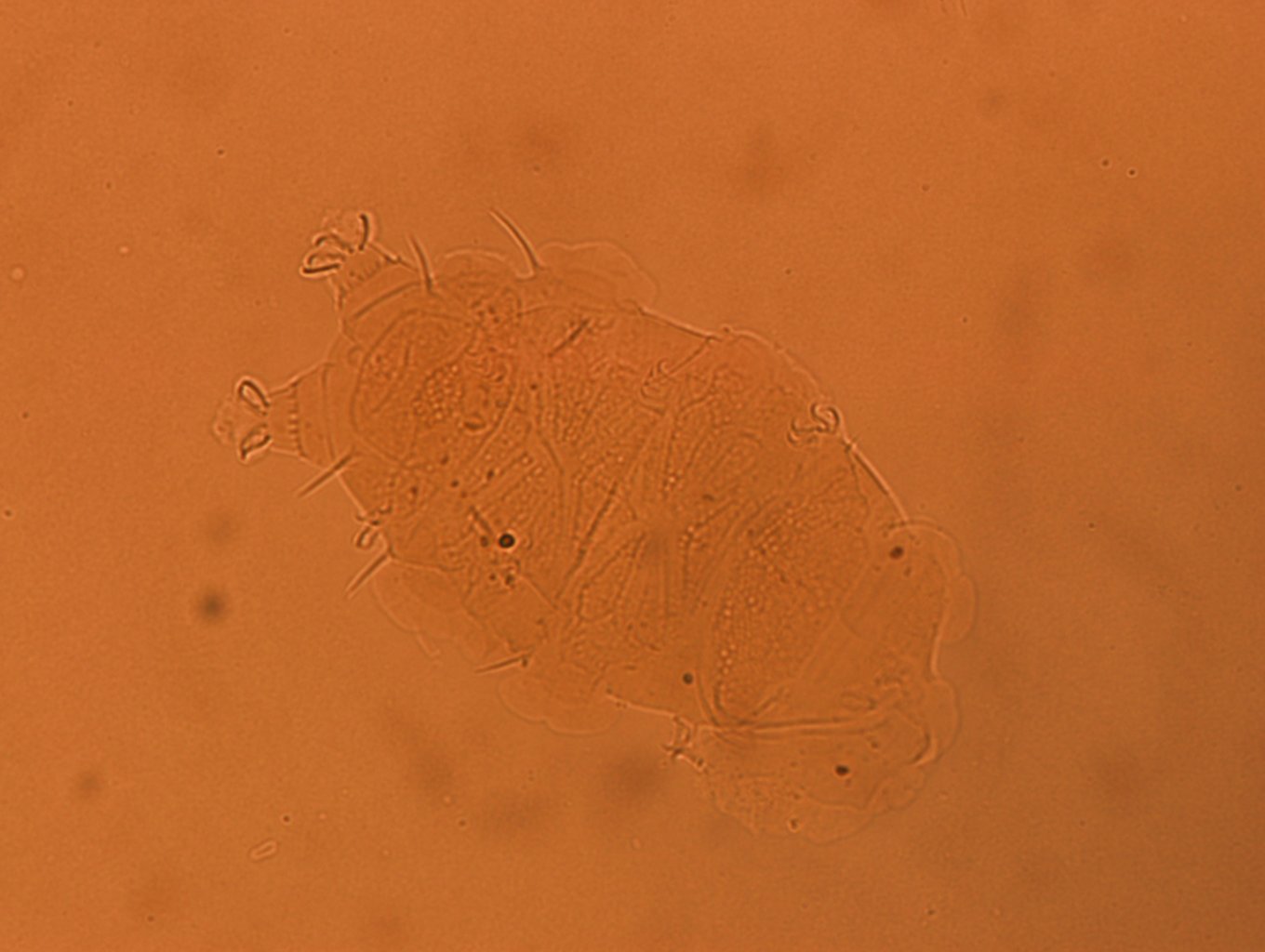 Echiniscus africanus image