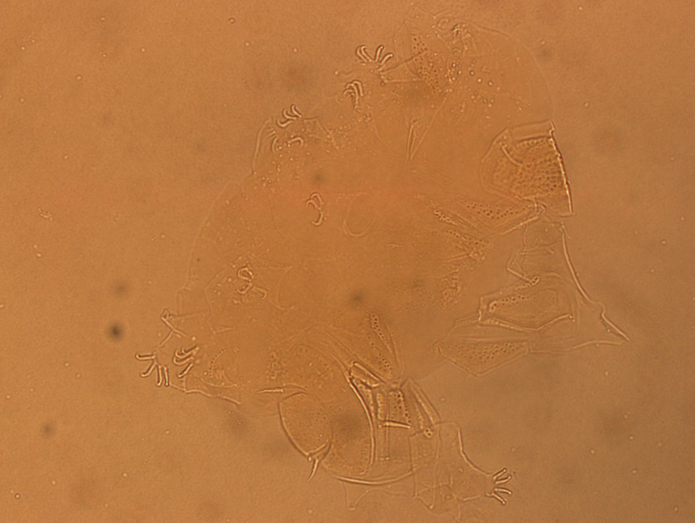 Echiniscus angolensis image