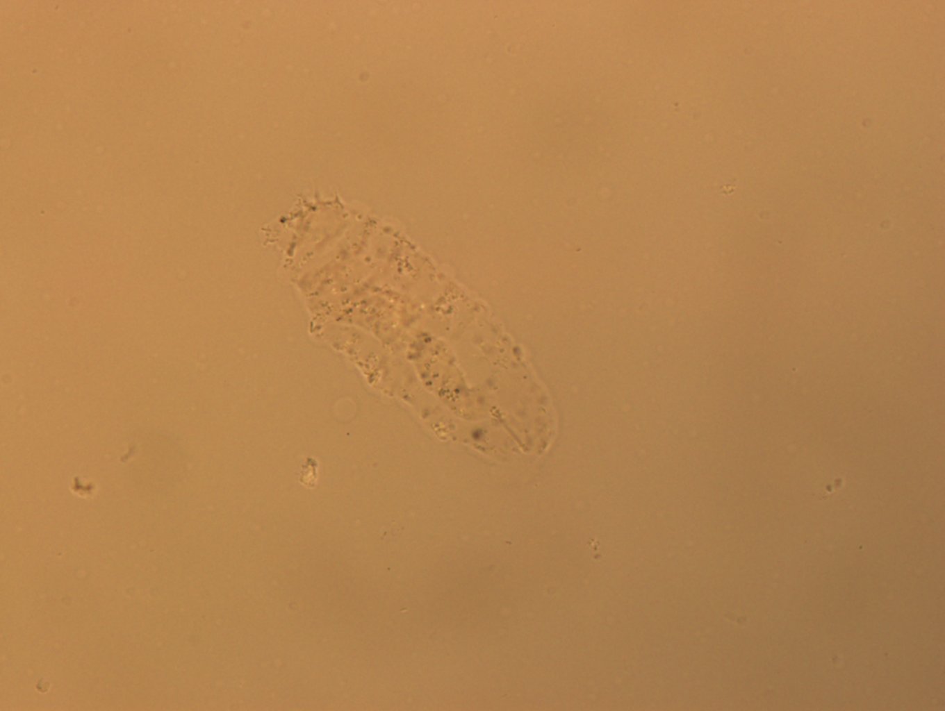 Calohypsibiidae image