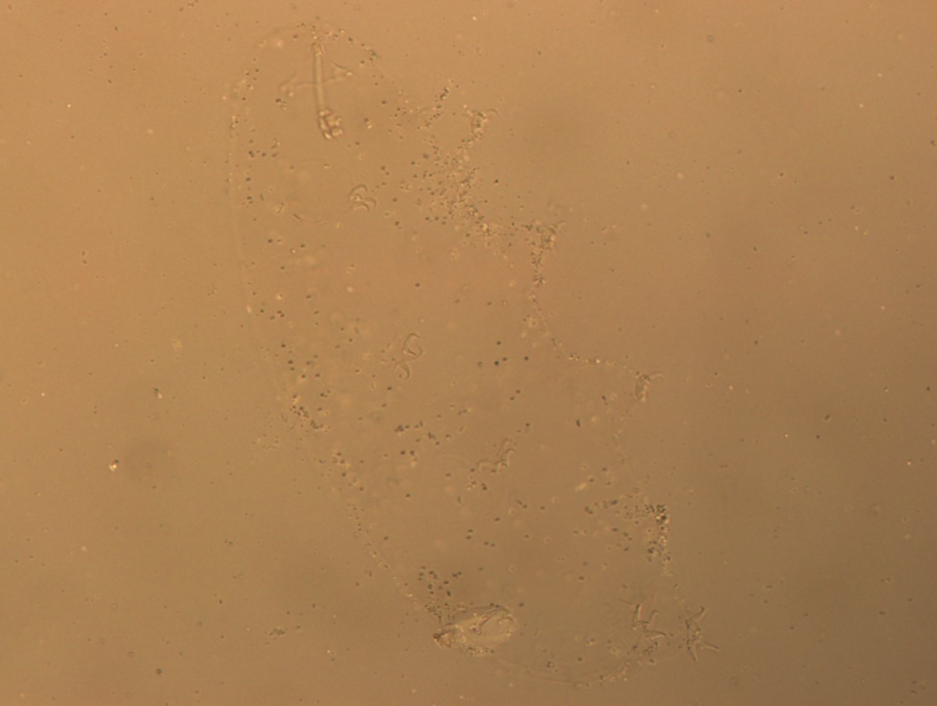 Hypsibius convergens image