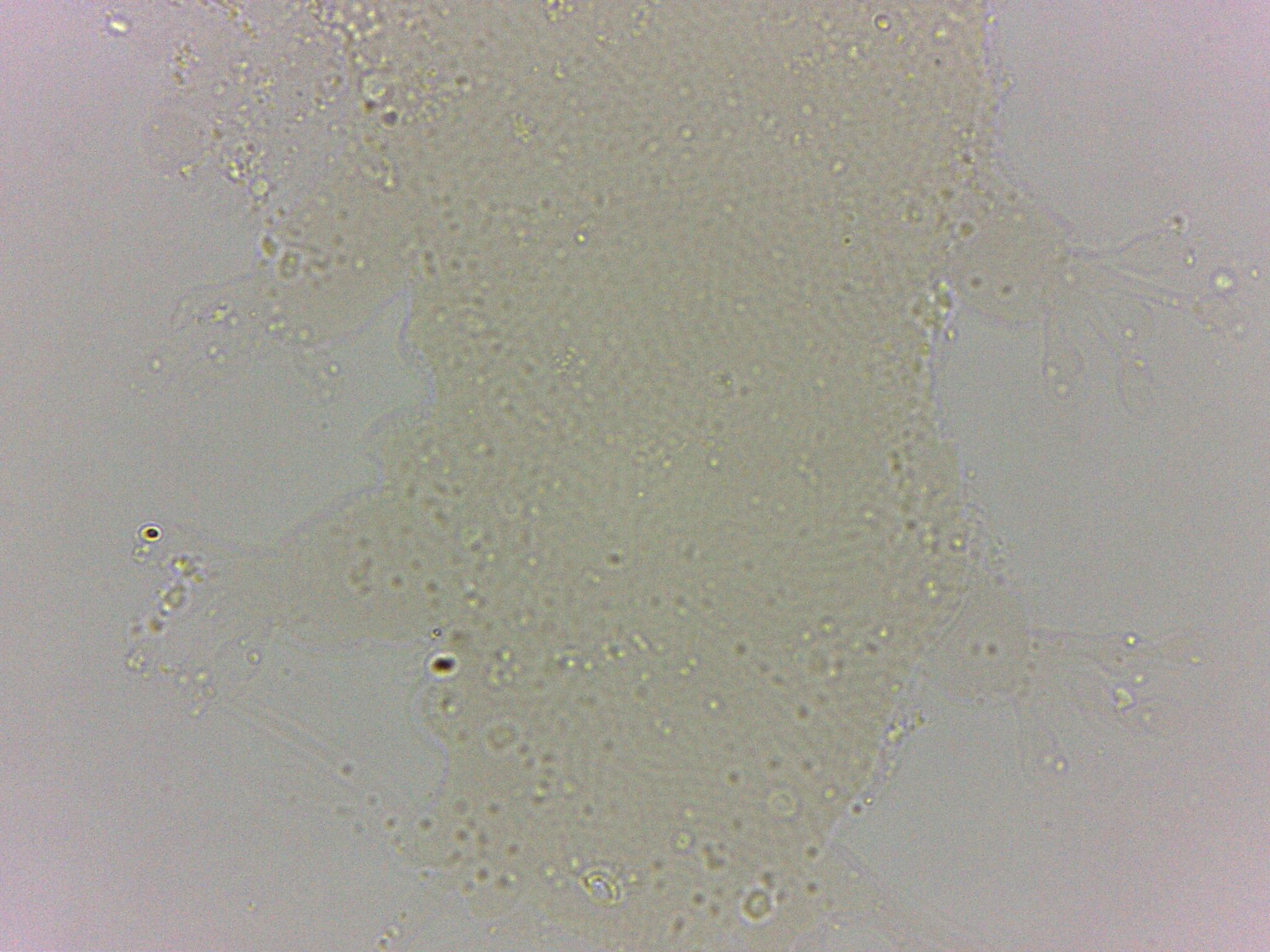 Batillipedidae image