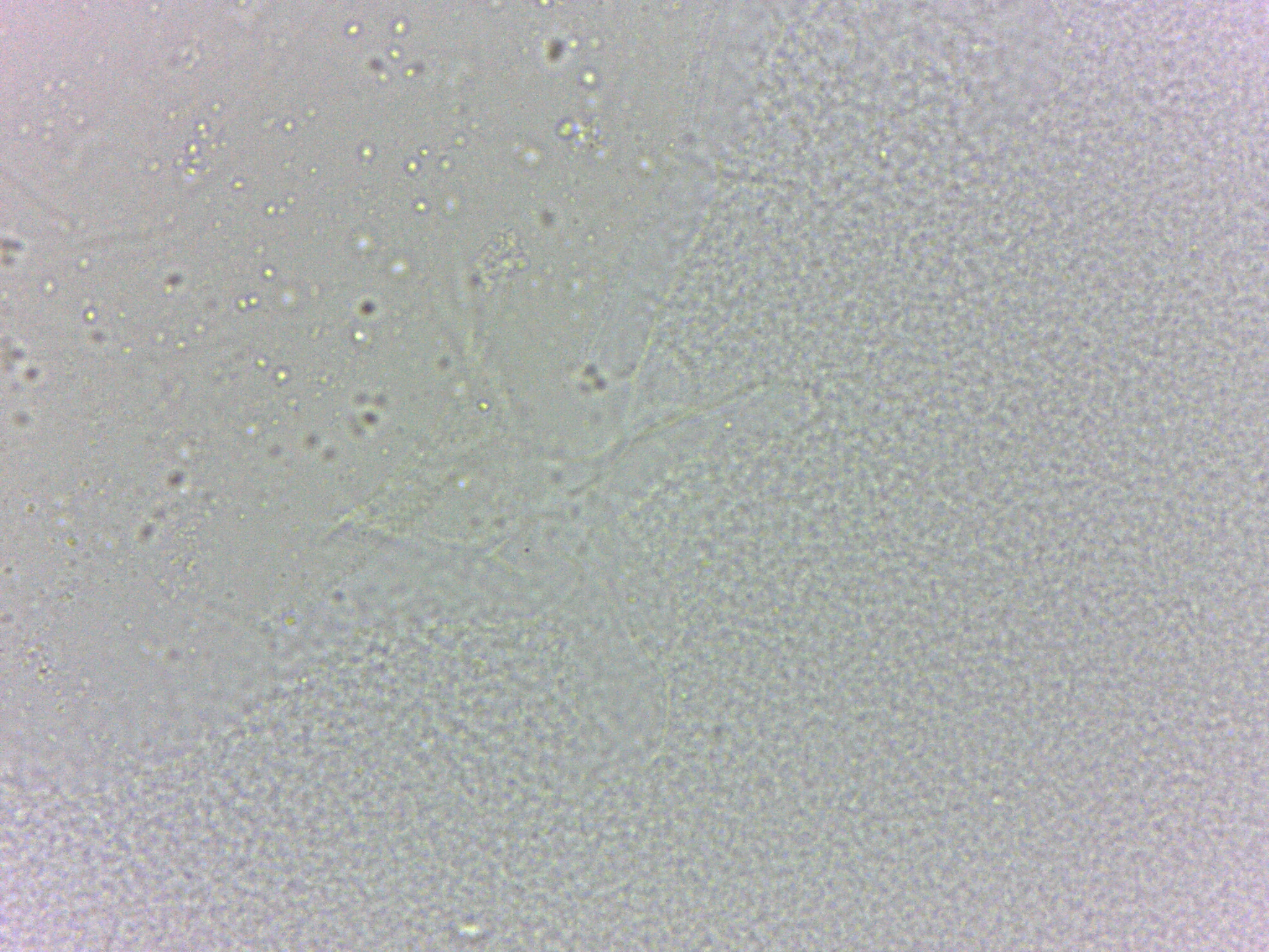 Batillipes minius image