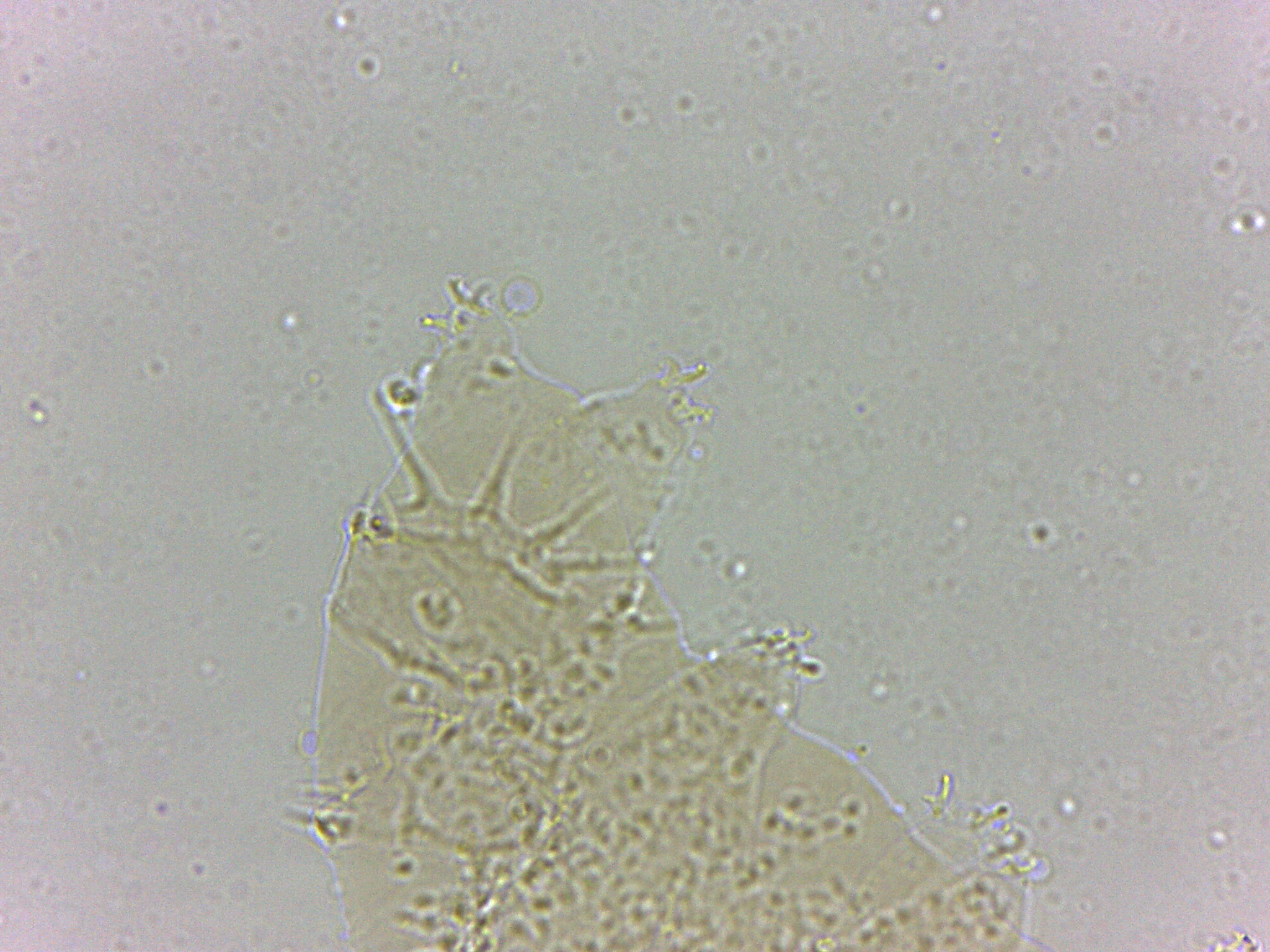 Calohypsibiidae image
