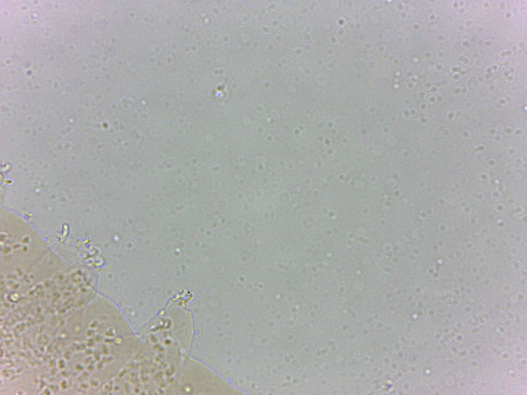 Calohypsibiidae image