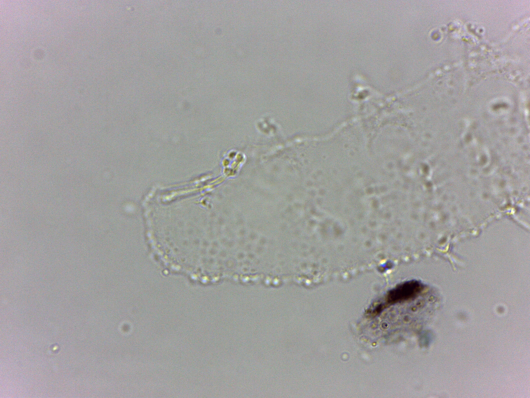 Calohypsibiidae image