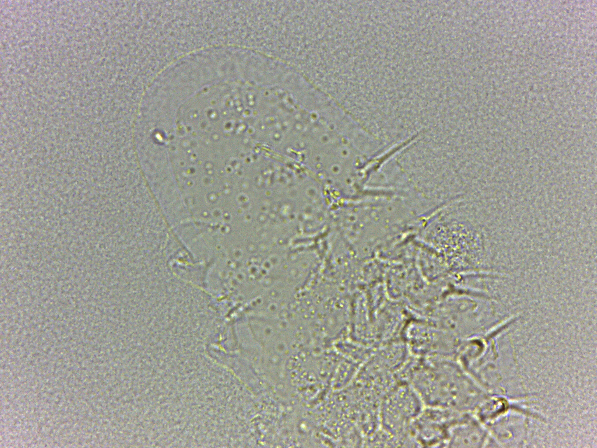 Calohypsibiidae image