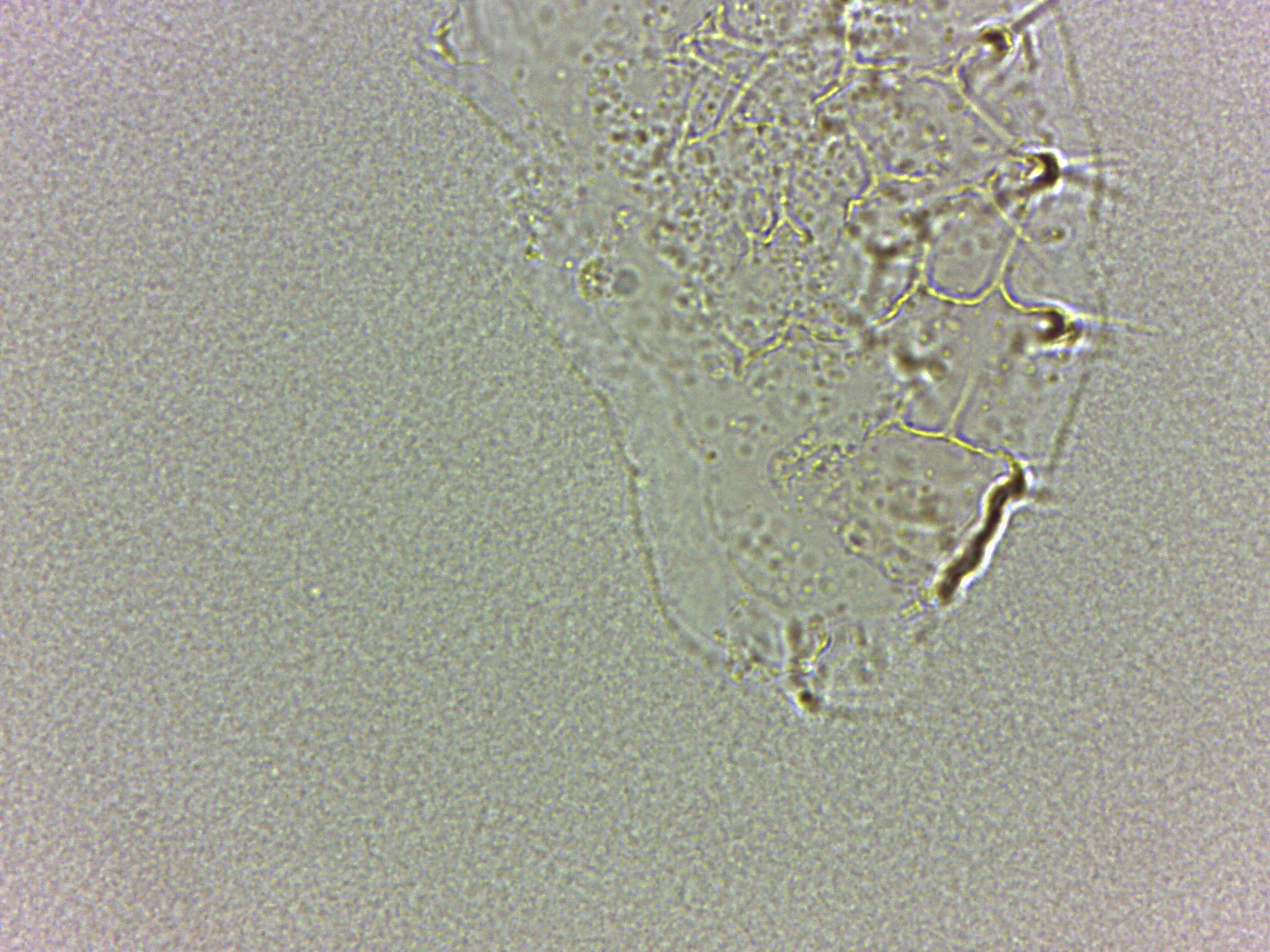 Calohypsibiidae image