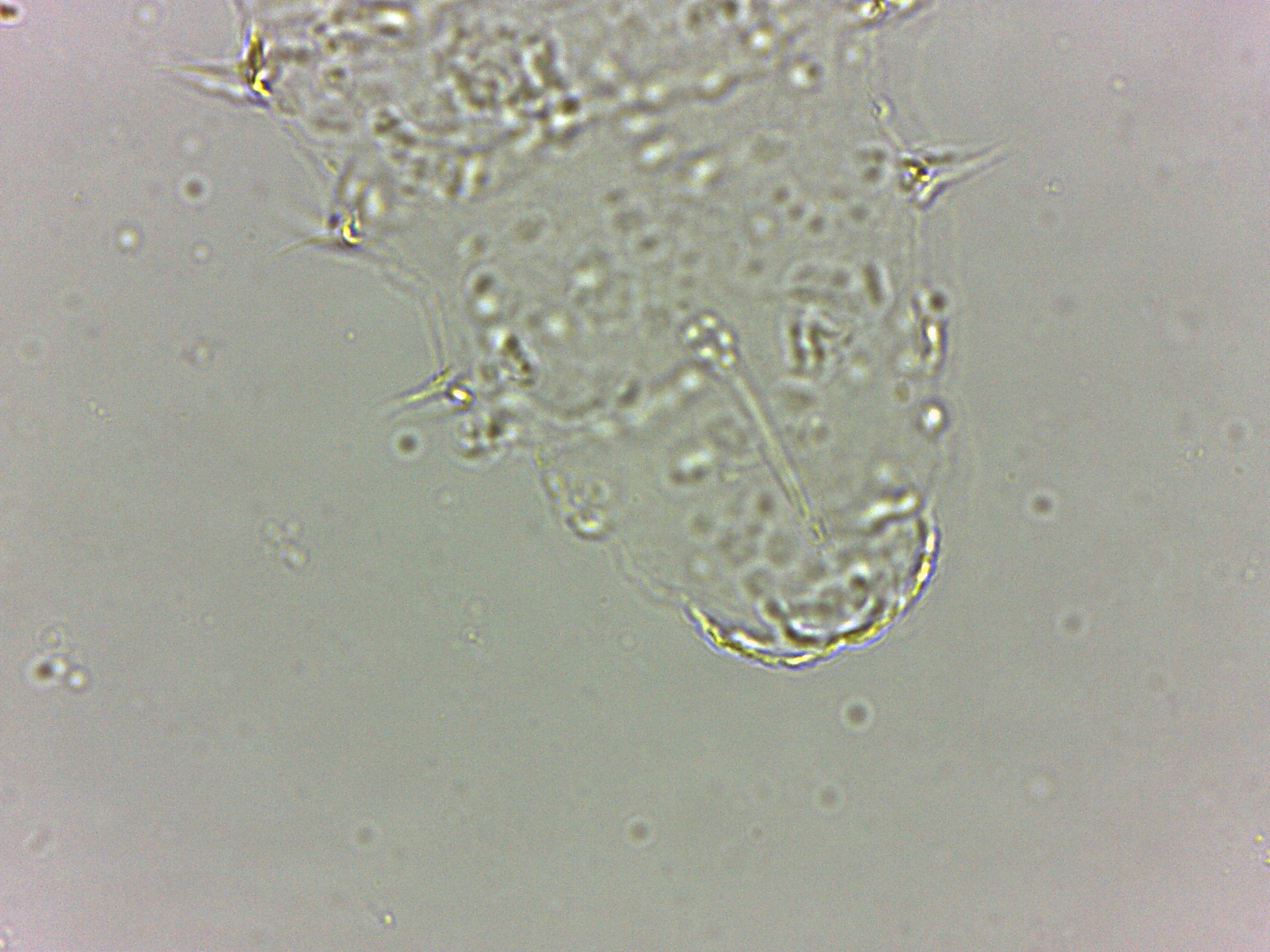 Calohypsibiidae image