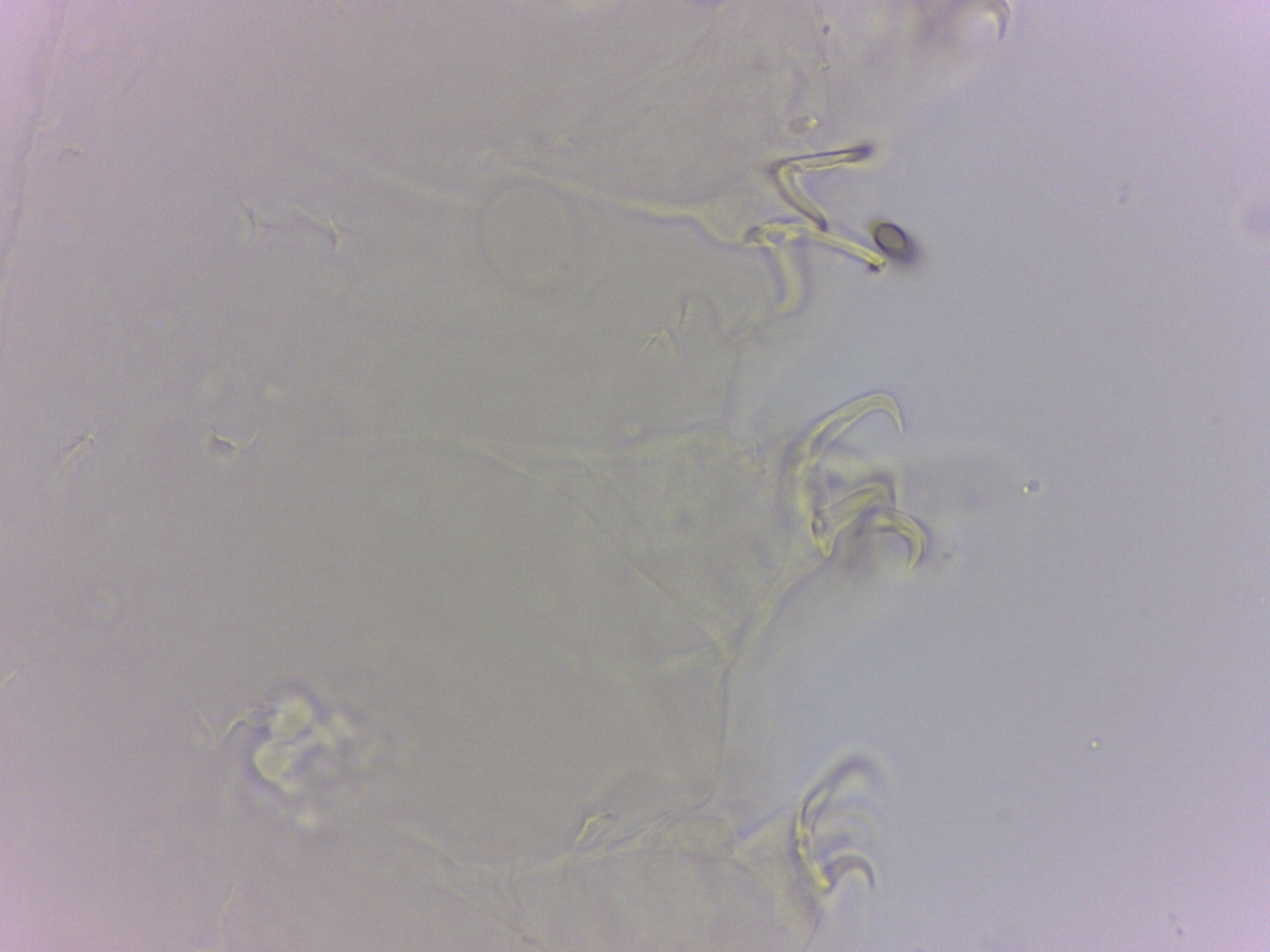Doryphoribius evelinae image