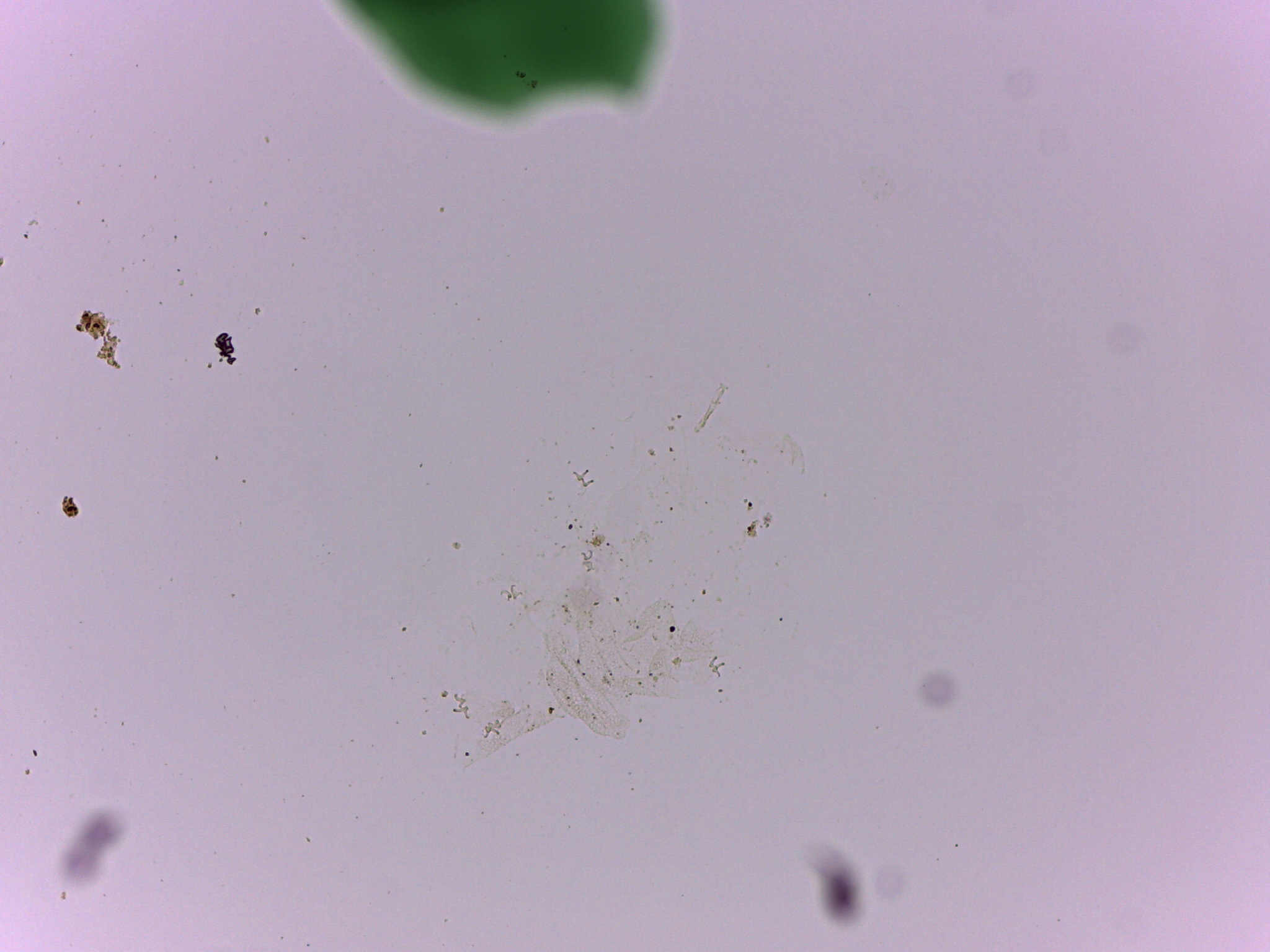 Doryphoribius flavus image