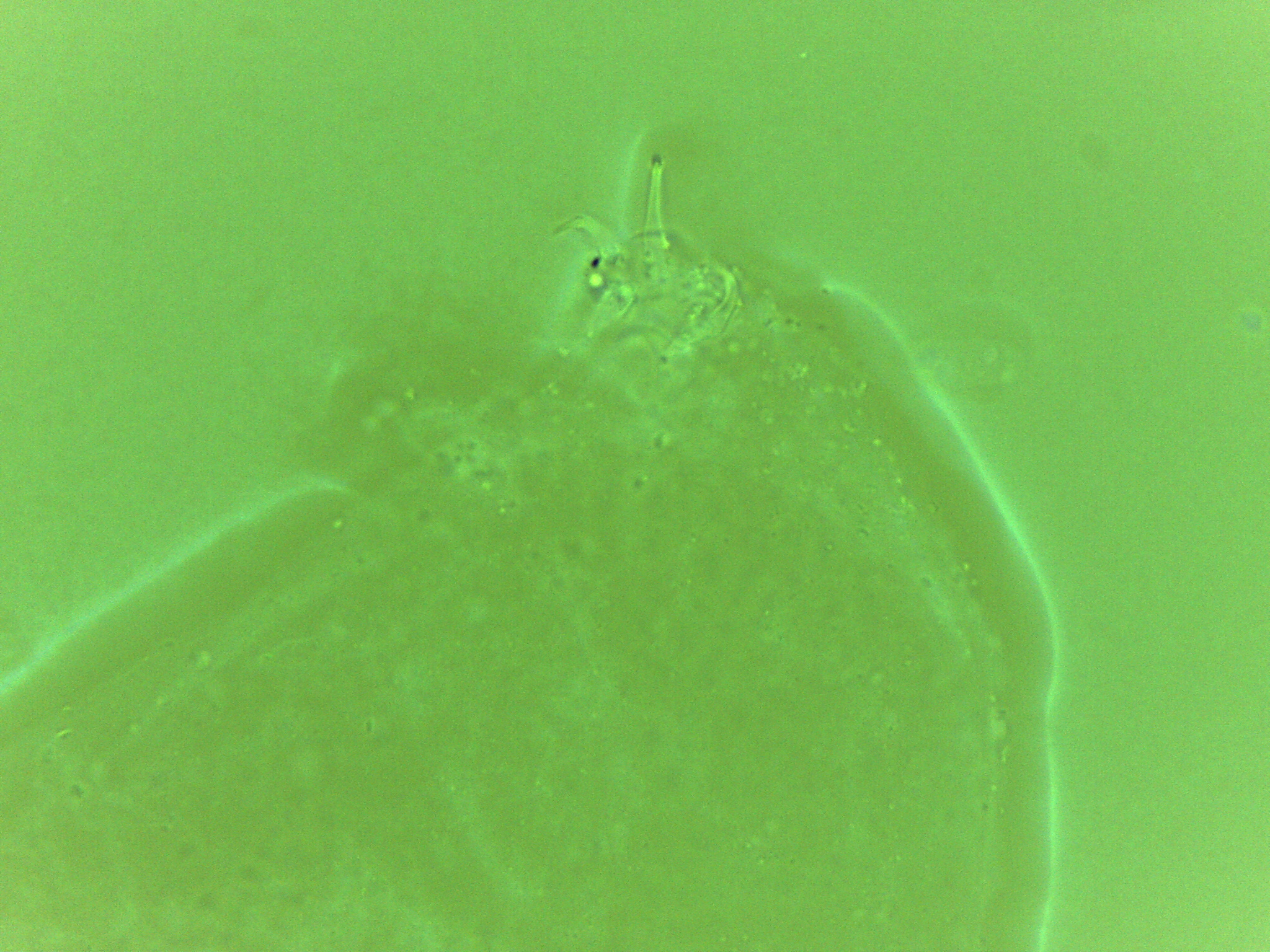 Doryphoribius zyxiglobus image