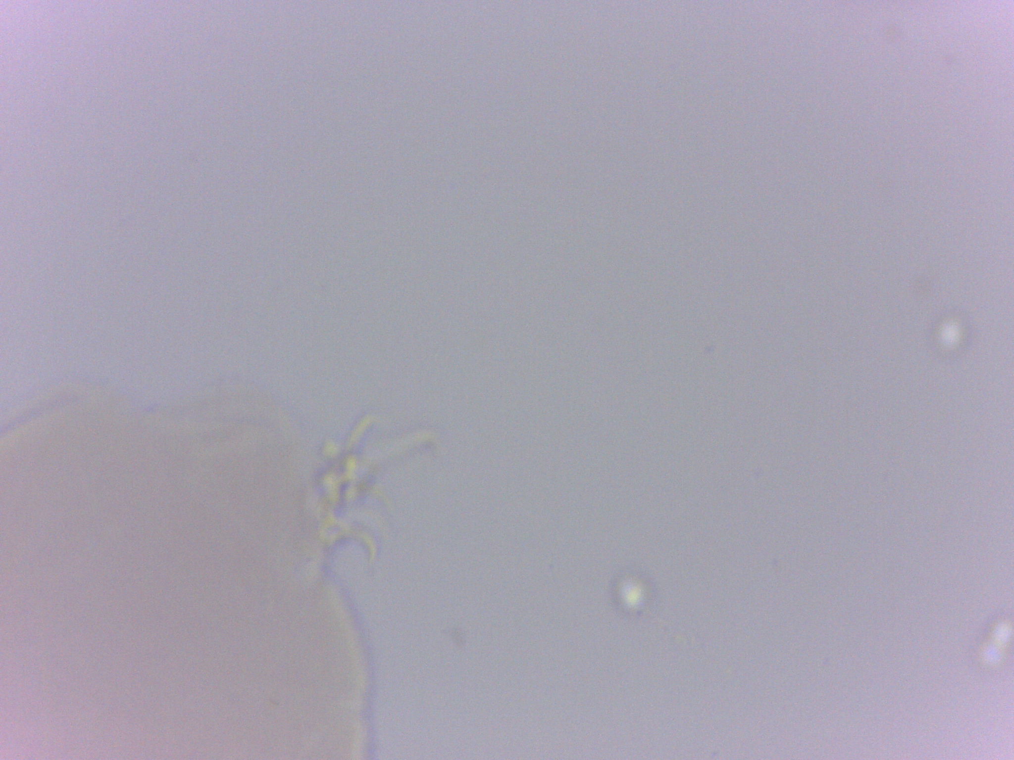 Doryphoribius zappalai image
