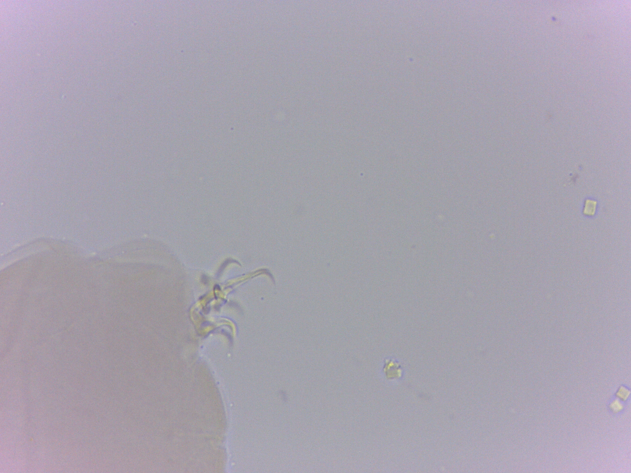 Doryphoribius zappalai image
